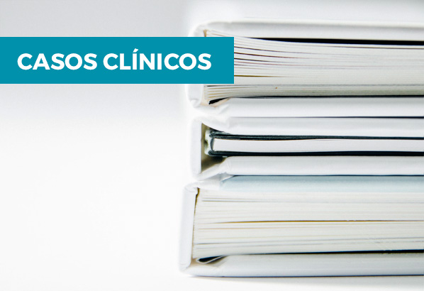 Casos clinicos