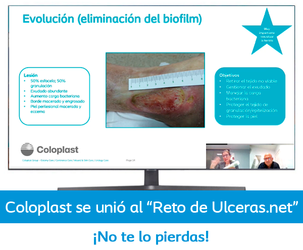 destacados en ulceras.net