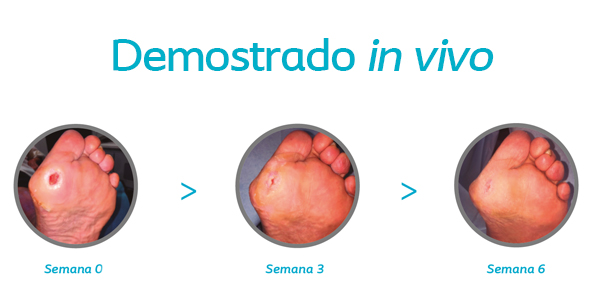 destacados en ulceras.net