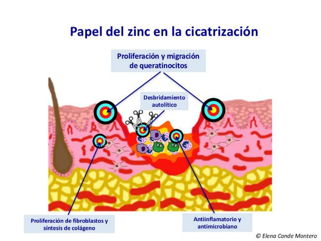 destacados en ulceras.net